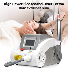 ND Yag Laser Tattooentfernung
