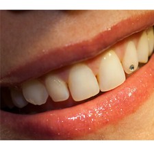 Zahnschmuck Steine ⚡