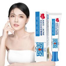 Pickel Entferner Akne Creme