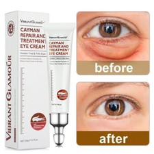 Magic Anti-Aging Eye Cream