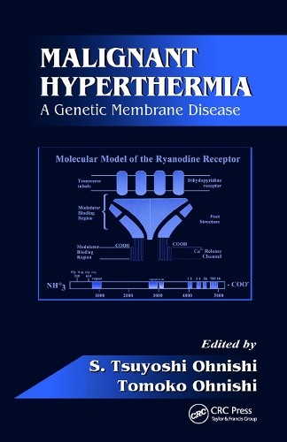 Malignant hyperthermia s - hyperthermia, by