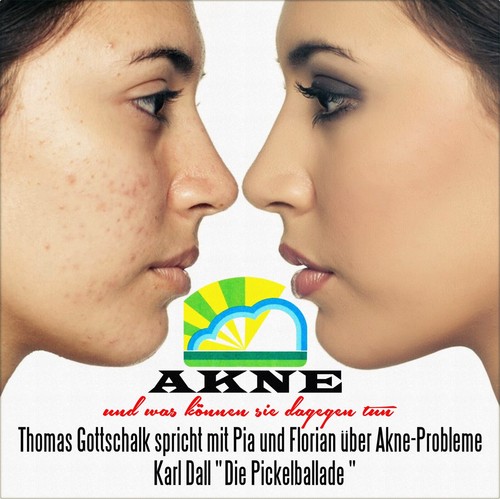 Thomas gottschalk akne - 7",