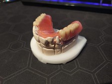 Zahnprothese Anschauungsmodell