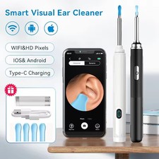 Ohrenschmalz Entferner Otoskop Wifi Ohrreiniger mit kamera 1080P HD-Otoskop DHL