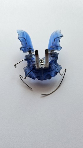 Lockere zahnspange - lockere,