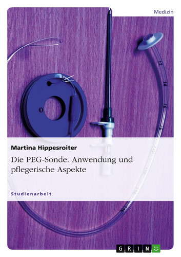 Die peg sonde anwendung - peg-sonde.,
