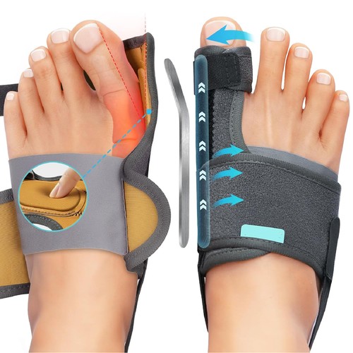 Hallux valgus korrektur - valgus,