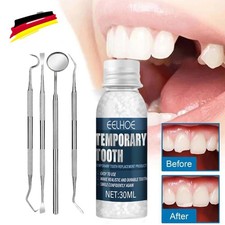 Set provisorischer Zahnersatz Temporärer Zahn Reparatur Lücke Füllung Cosplay DE
