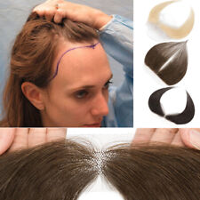 Damen Stirn Haaransatz Topper