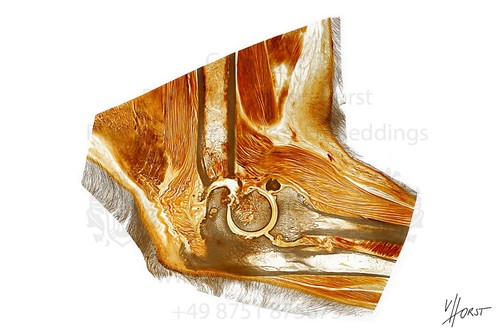 Lehrtafel anatomie und - lehrtafel,