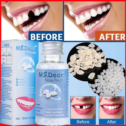 Tooth repair kit temporary - tooth,