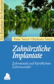 Zahnärztliche implantate - zahnärztliche,