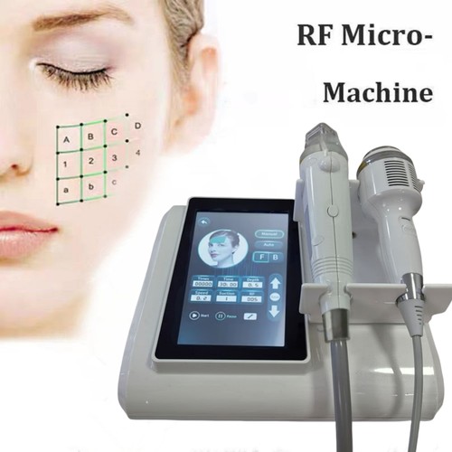 Radiofrequenz needling - radiofrequenz,
