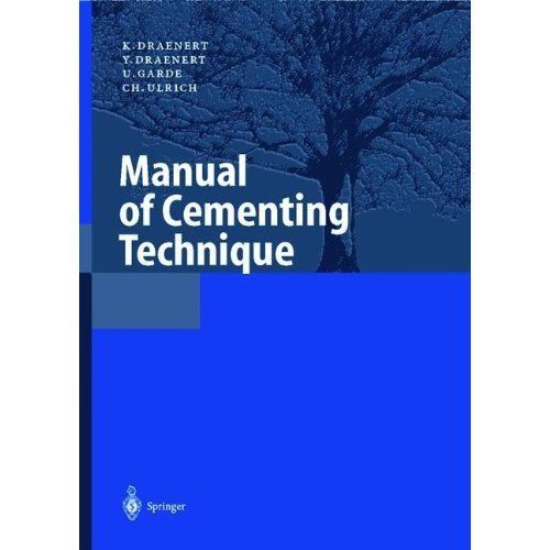 Manual cementing technique - of,