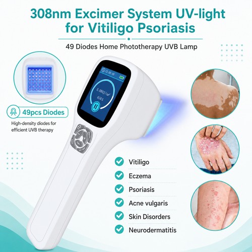 Schmalband therapy lamp - uv,