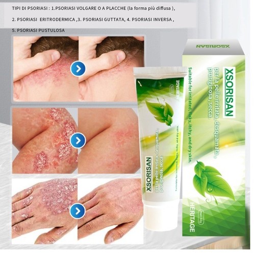 Xsorisan creme gegen - xsorisan,