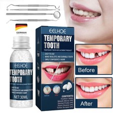 Provisorischer Zahnersatz Set