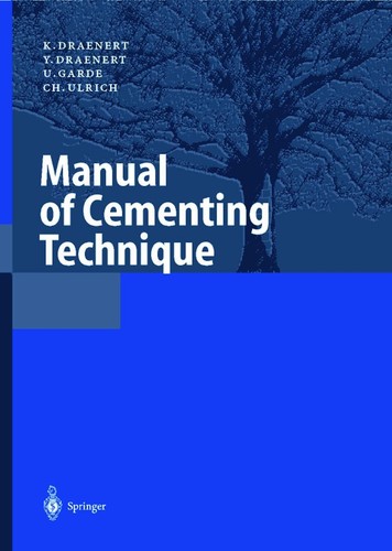 Manual cementing technique - of,
