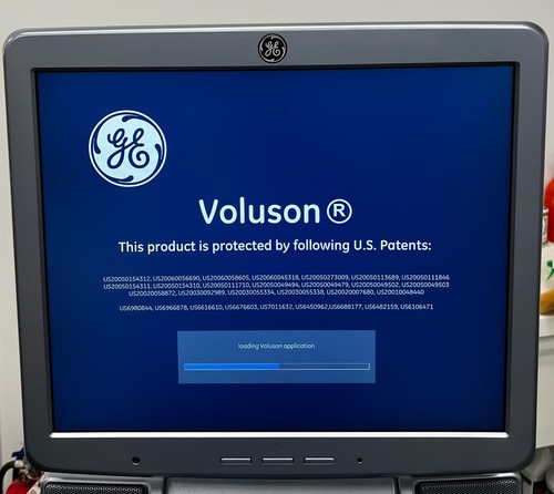 Voluson ultrasound - voluson,