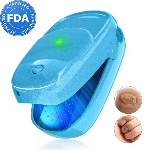 Nagelpilz laser gerät - nagelpilz, laser-gerät