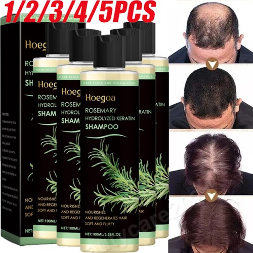 1-5X