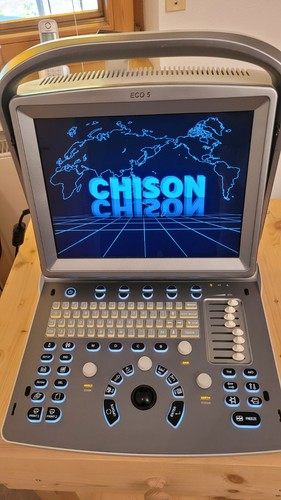 Chison eco ultraschallsystem - 5,