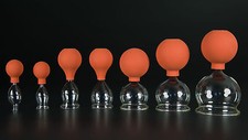 7er schröpfset ball - m.,