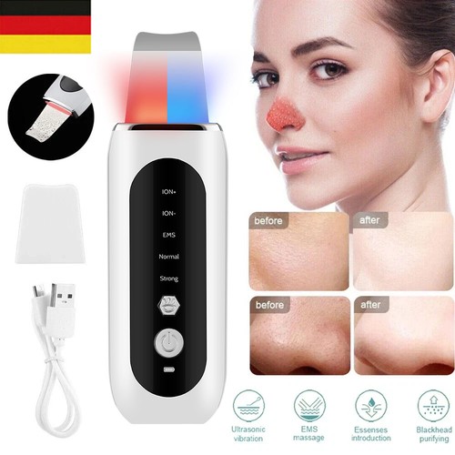 Ultraschallpeelinggerät
