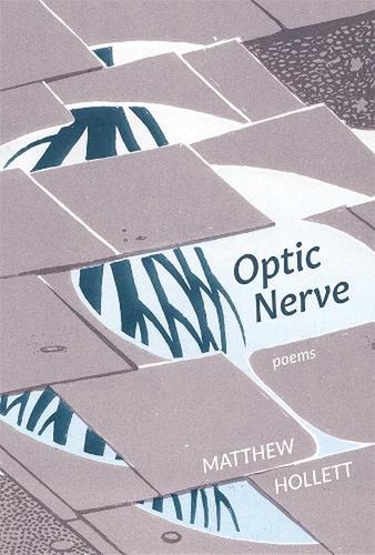 Optic nerve matthew - nerve,
