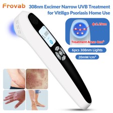 308nm excimer uvb - uvb, light