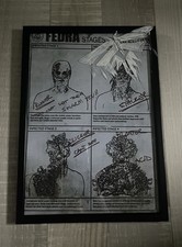 The Last Of US - Fedra, Stufen