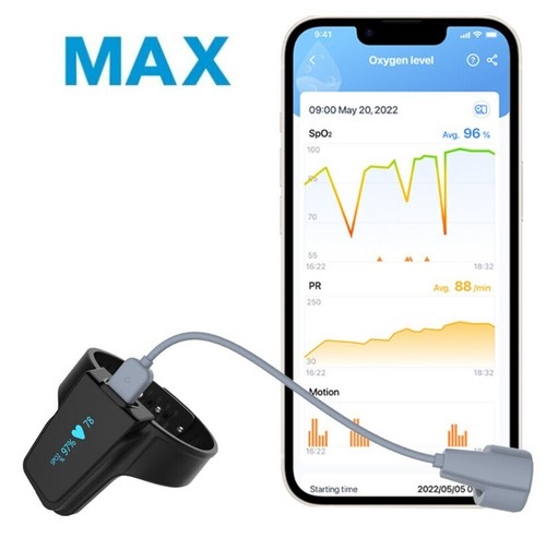 Viatom wellue checkme max - wellue,