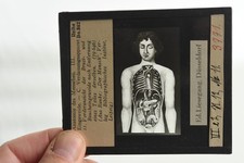 Alt Glasdia | Medizin Anatomie Lehrmittel Mensch Verdauung | Großformat Vintage