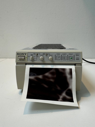 Sony video graphic printer - graphic,