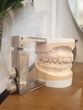 Scheu Dental - Split Fixator 5380