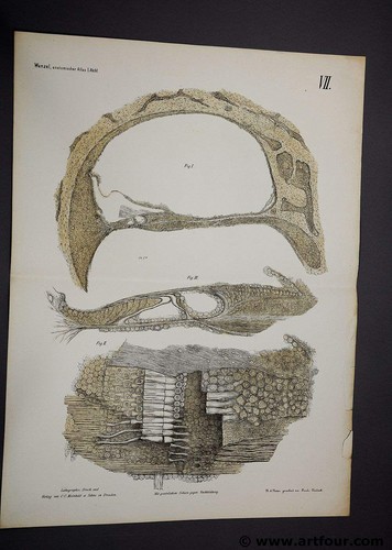 Wenzel 1875 alte anatomie - wenzel,
