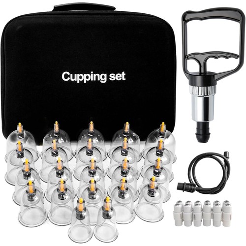 Schröpfgläser set - schröpfgläser,