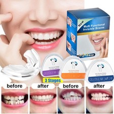 Zahnspange-Dental-Brace-3X-Ret