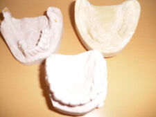 Gebissabdruck Zahnabdruck Gipsabdruck Zahnmodell Kiefer Dental Lehrmittel