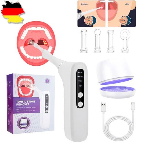 Electric vacuum tonsil stone - electric,