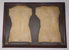 Deutsches Hygienemuseum Dresden Schautafel ca. 1925