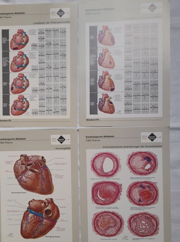 Set kardiologie bildtafeln - kardiologie,