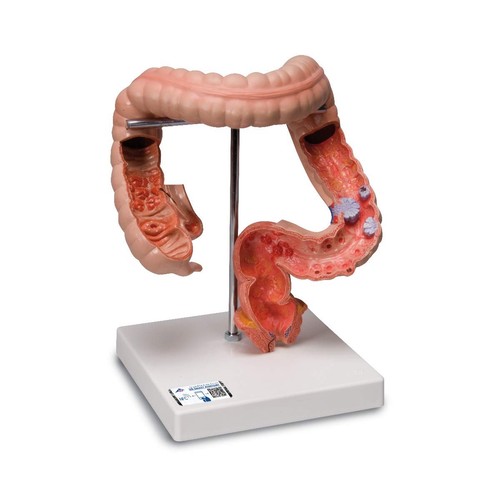 Scientific dickdarm modell - 3b,