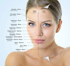  Botox Medical HealthCare