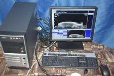 Sonomed Vumax II UBM