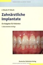 Zahnärztliche Implantate: Ein Ratgeber für Patiente... | Buch | Zustand sehr gut
