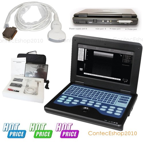 Ultraschallscanner digitaler - ultraschallscanner,