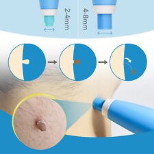 Stielwarzen Entferner, Skin Tag Entferner,2-in-1 Stielwarzen Entfernen schnell
