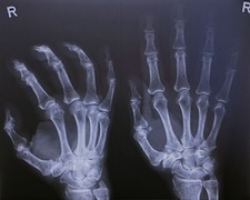 20 Original Röntgenbilder