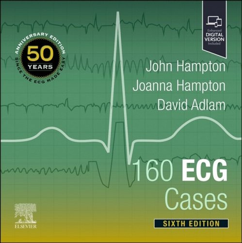 160 ecg cases hampton - ecg,